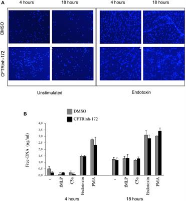 Type-4 Phosphodiesterase (PDE4) Blockade Reduces NETosis in Cystic Fibrosis